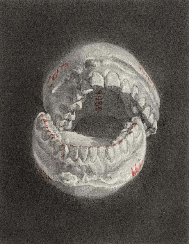 Nathan Reidt - Teeth Cast